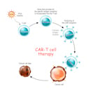 CAR -T therapy module CAR -T therapy module