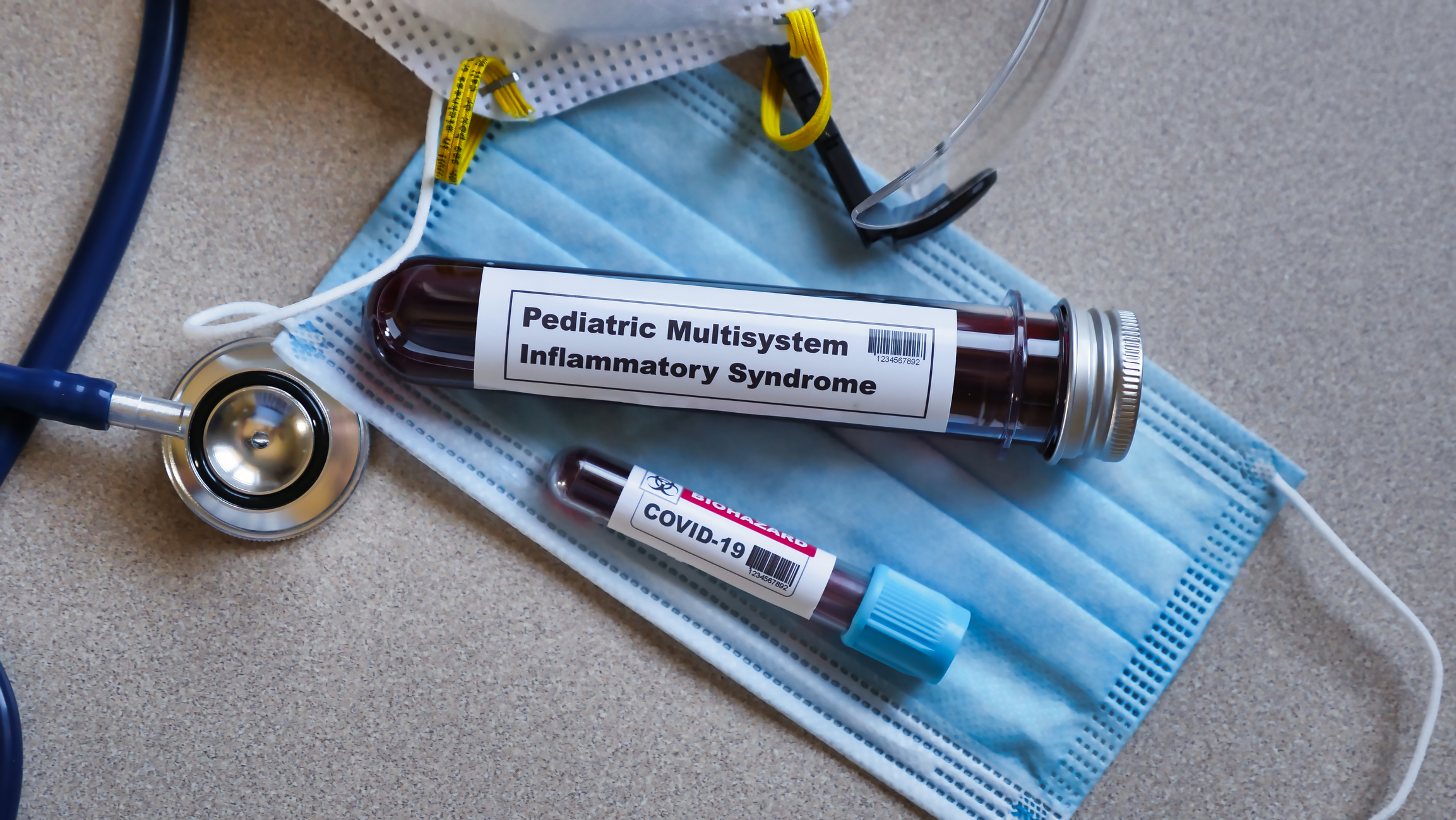 COVID Inflammatory Syndrome COVID Inflammatory Syndrome