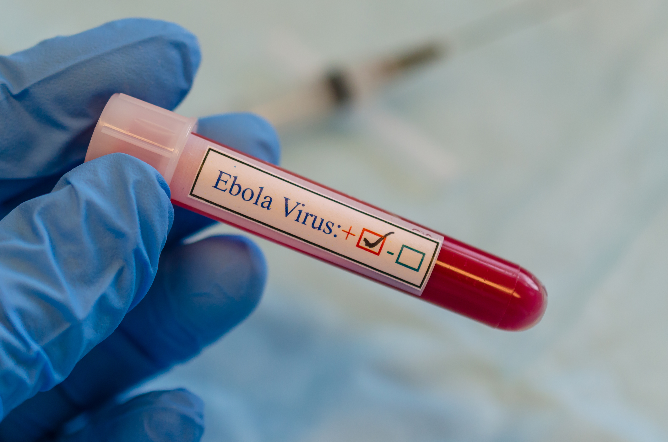 Ebola positive blood test Ebola positive blood test