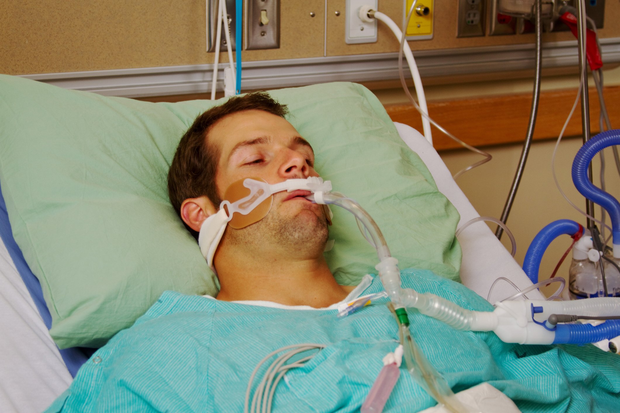 Patient hospitalized with EVALI Patient hospitalized with EVALI