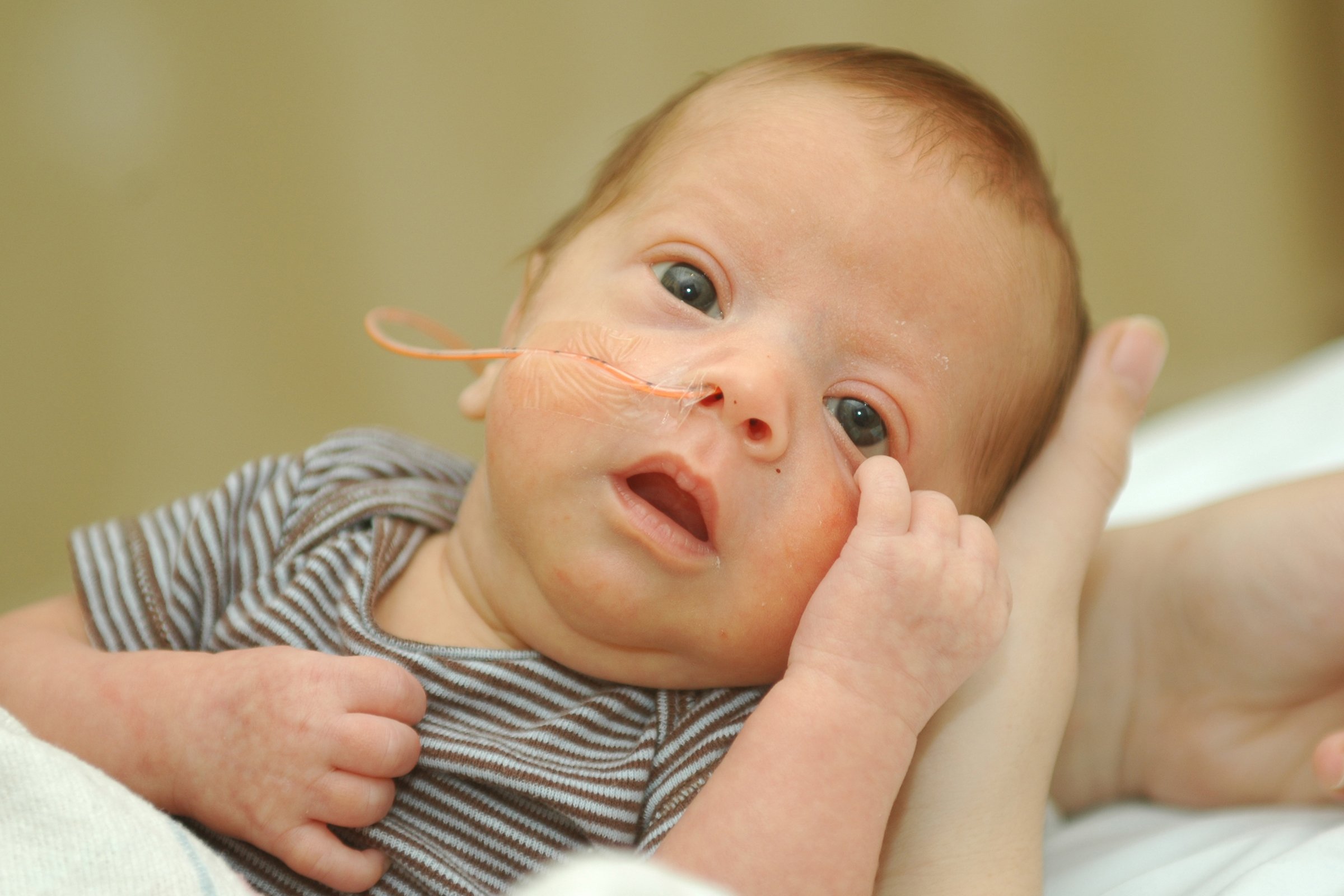 Newborn with a feeding tube Newborn with a feeding tube