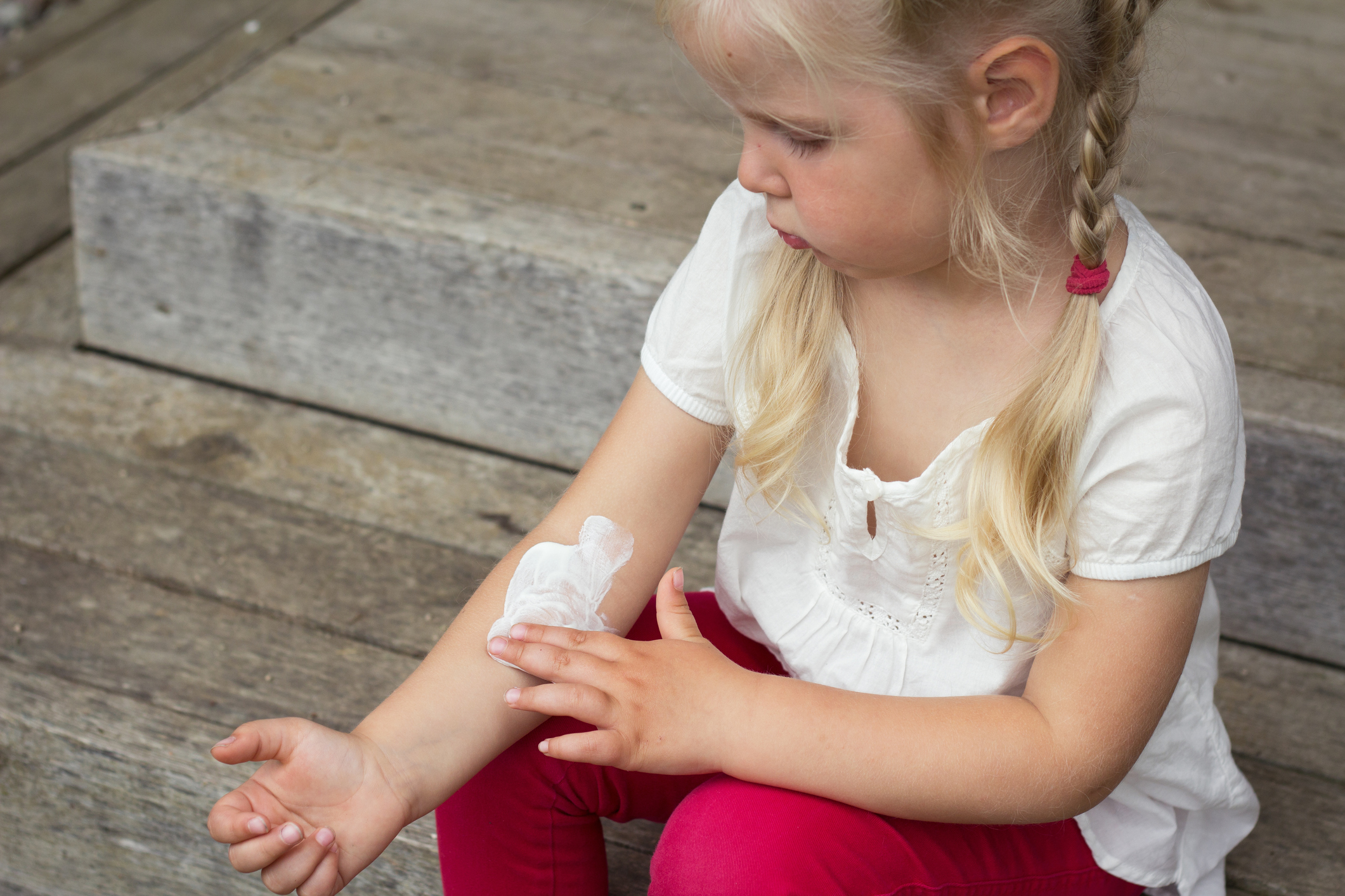 Little girl putting eczema cream on her arm. Little girl putting eczema cream on her arm.