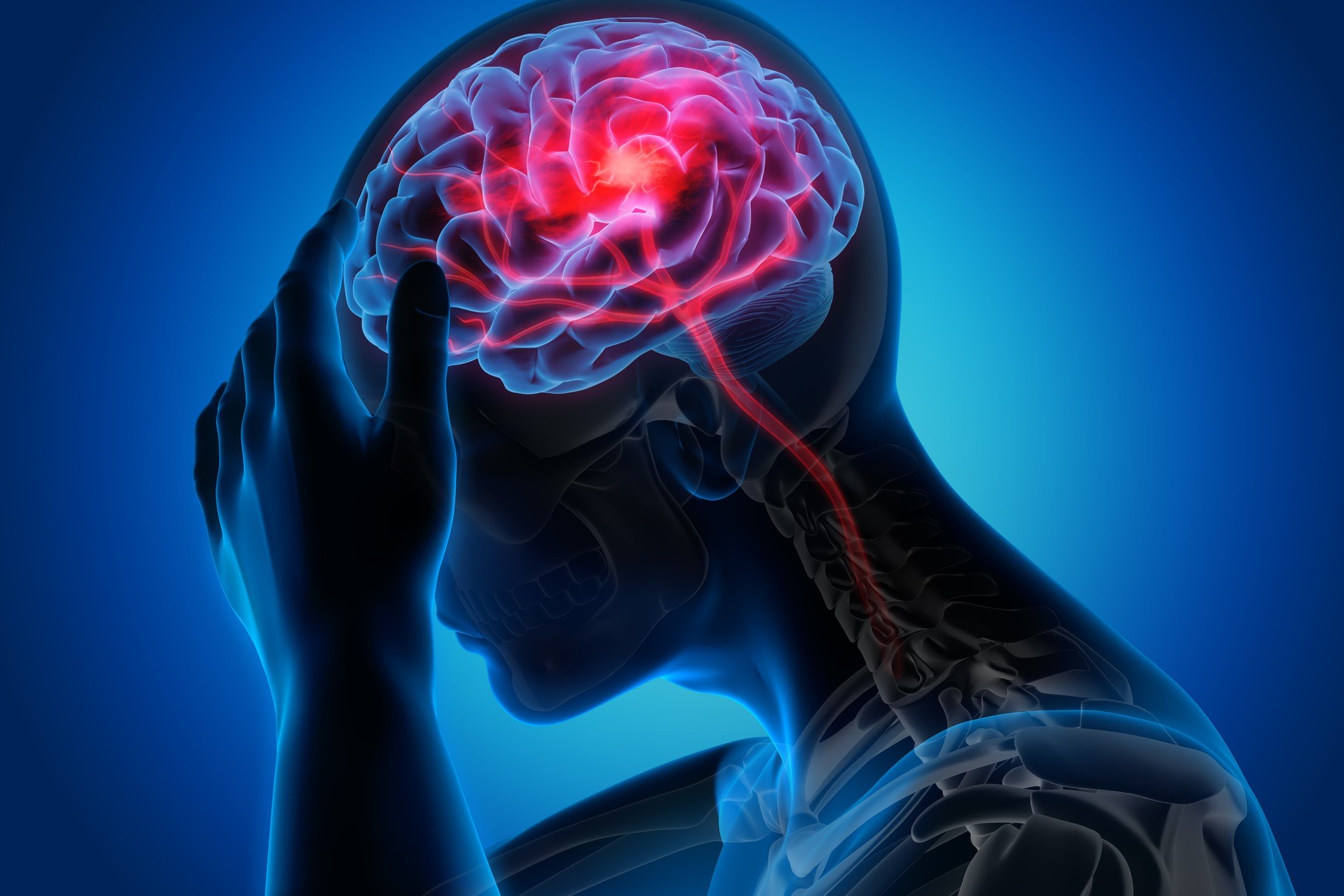rendering of blue human head and pink brain where stroke occurs rendering of blue human head and pink brain where stroke occurs