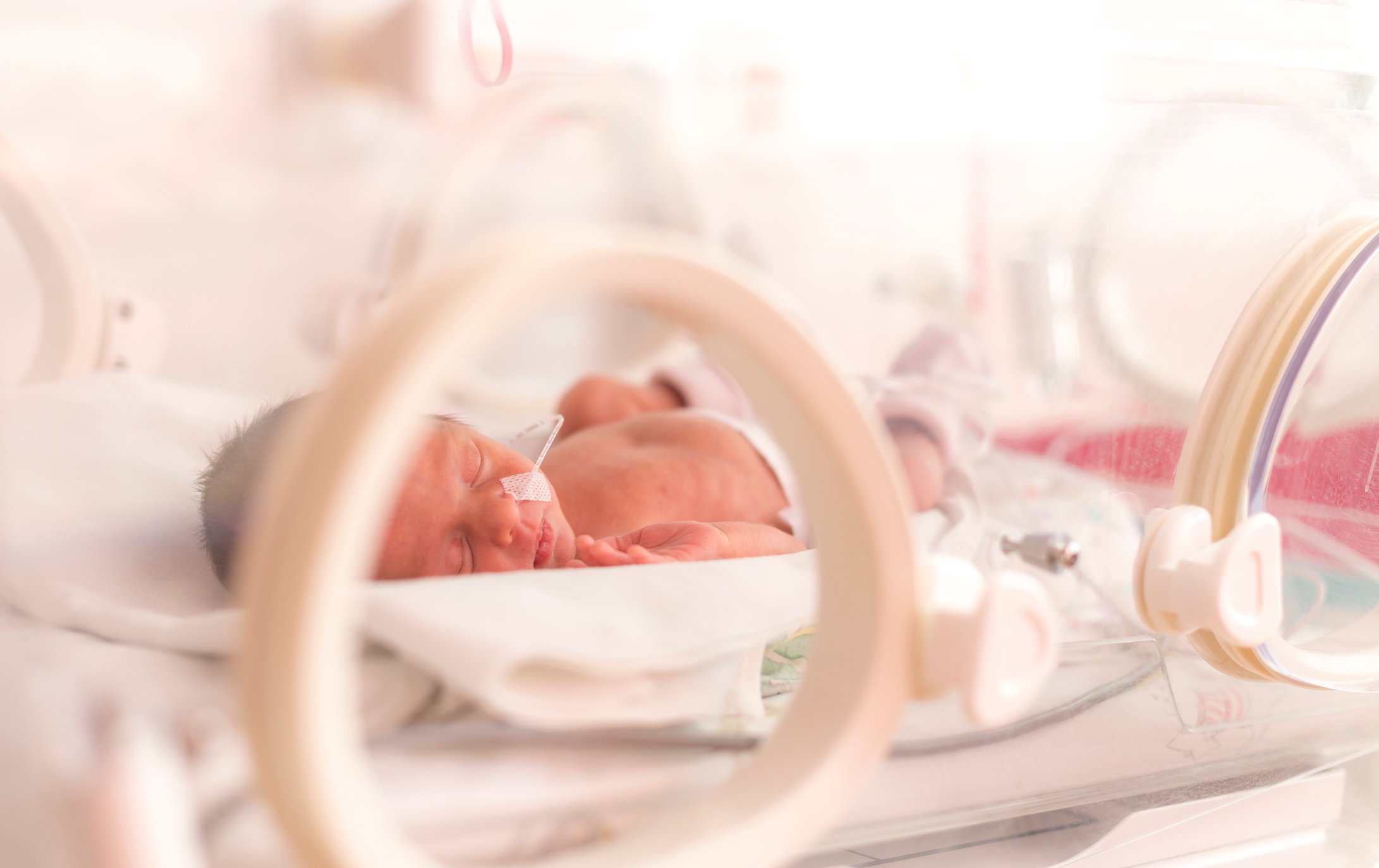 A baby with sepsis in an incubator A baby with sepsis in an incubator