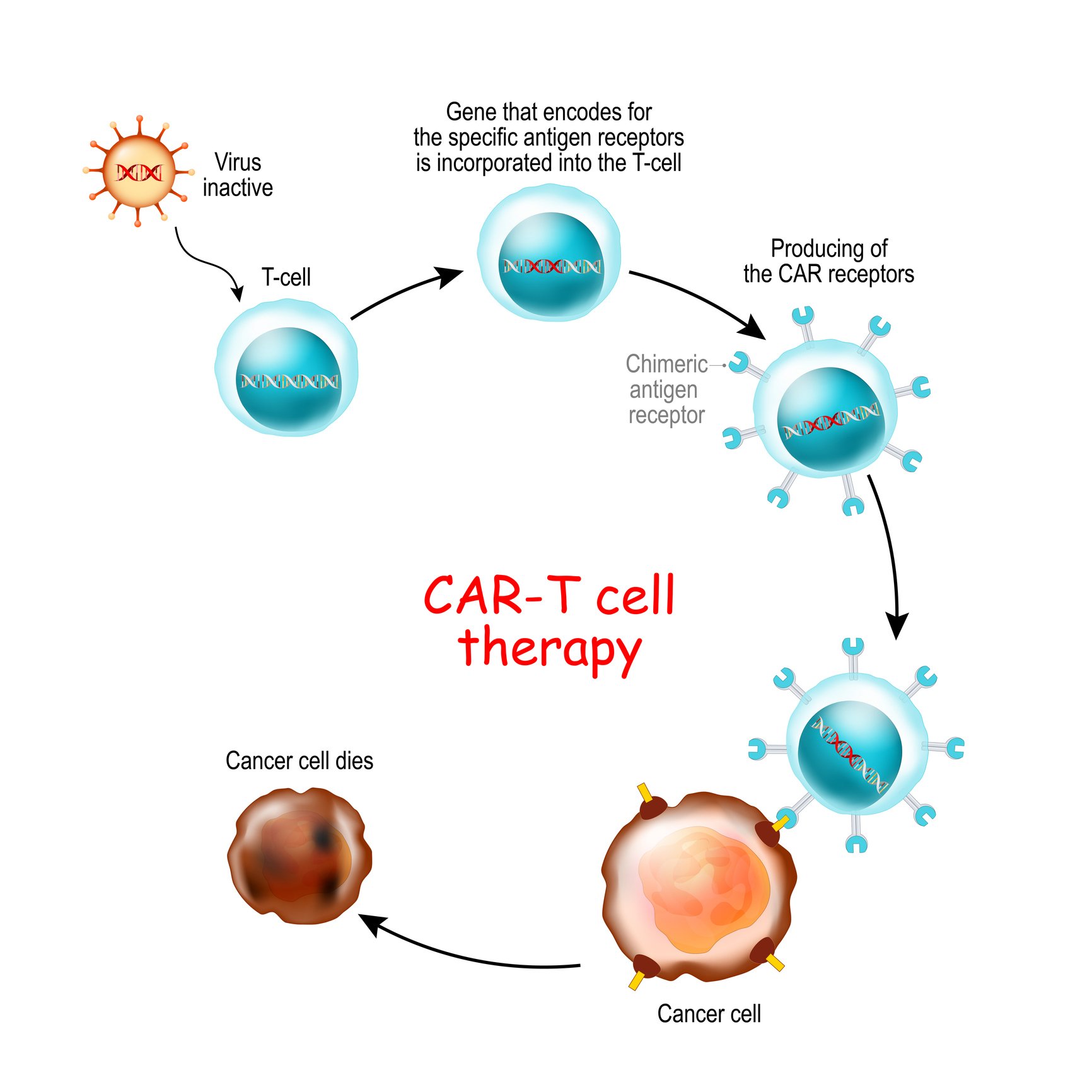 CAR -T therapy module CAR -T therapy module